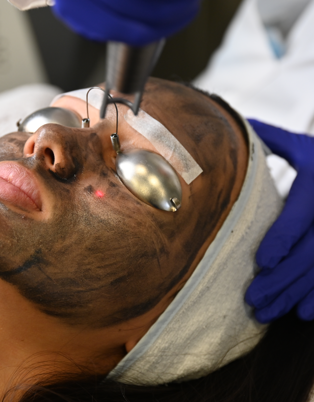 Карбоновый пиллинг (Spectra)​