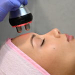 Регенерация​