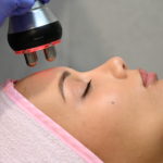 Регенерация​