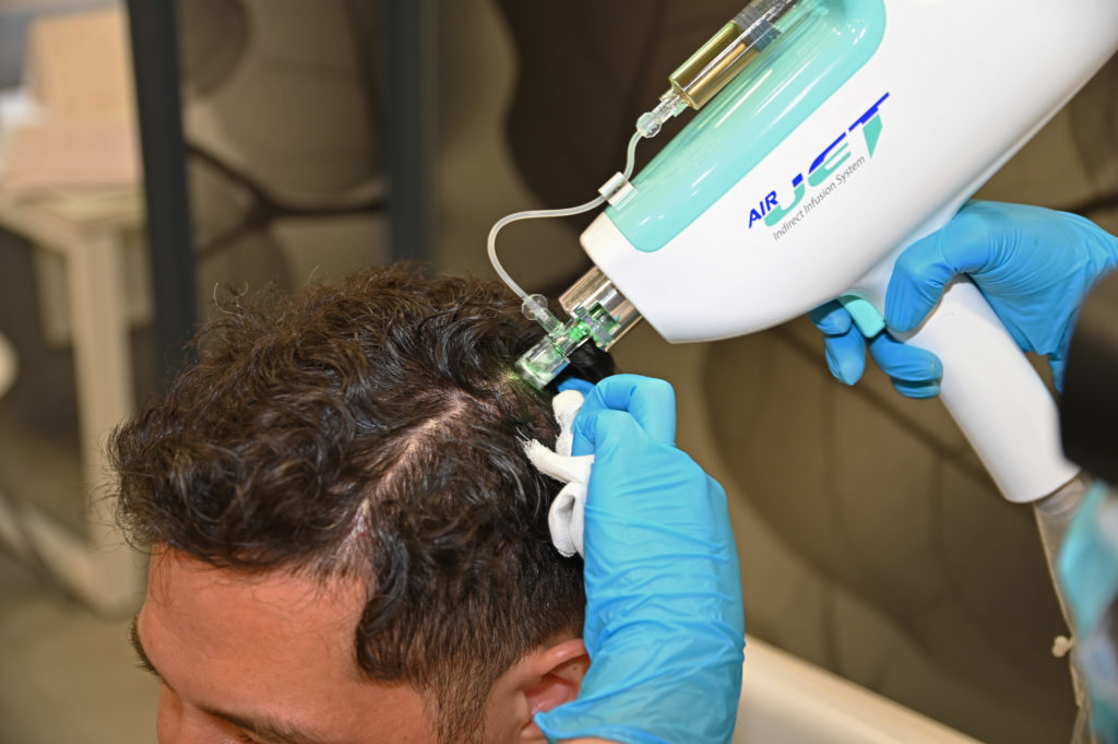 Процедура Air Jet