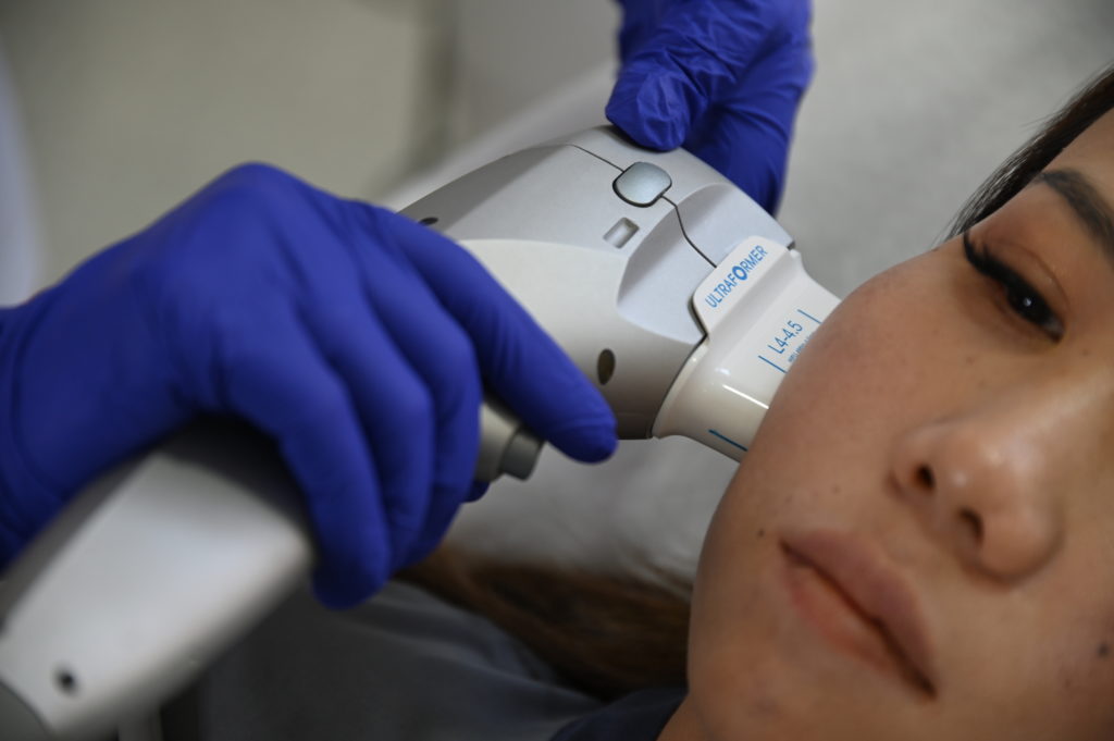 SMAS-лифтинг — безоперационная подтяжка лица с использованием ультразвука