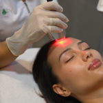 Infini/Микроигольчатый RF лифтинг