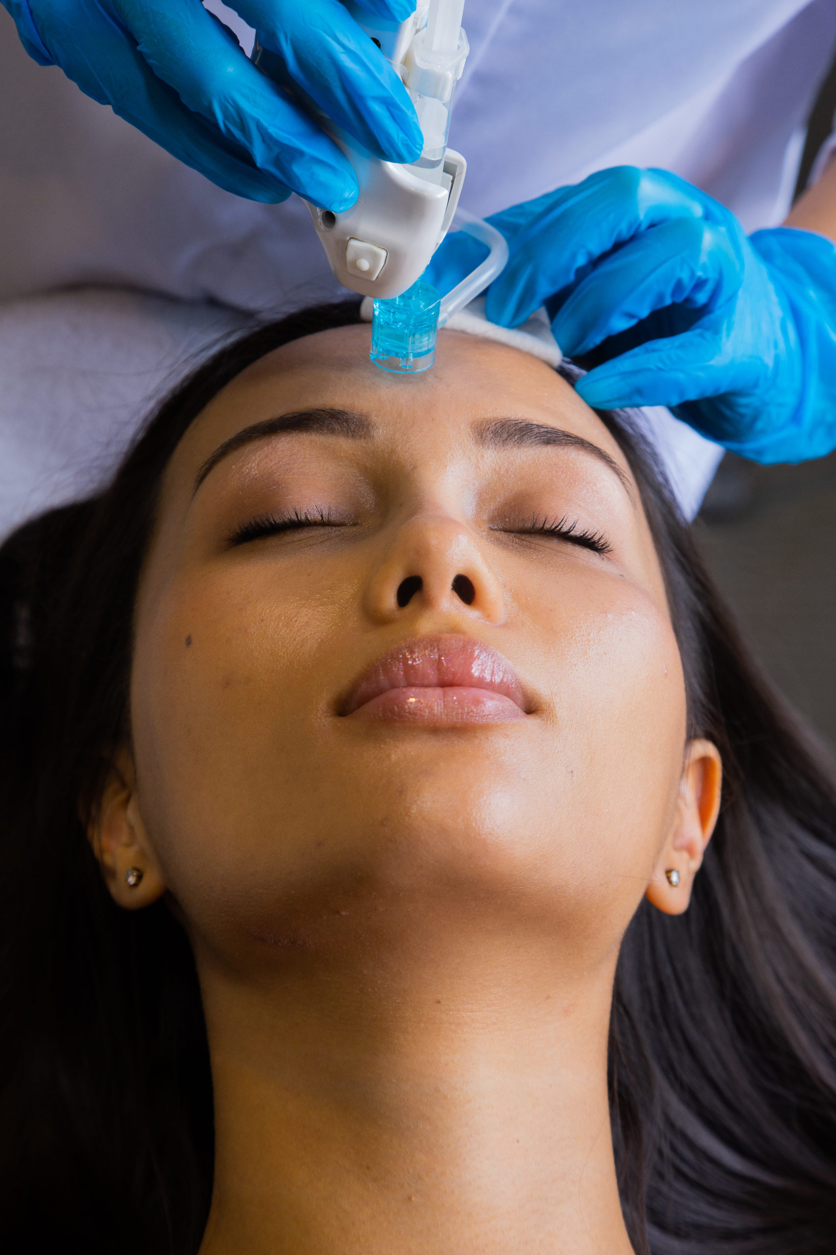 Аппаратная мезотерапия на аппарате Dermashine