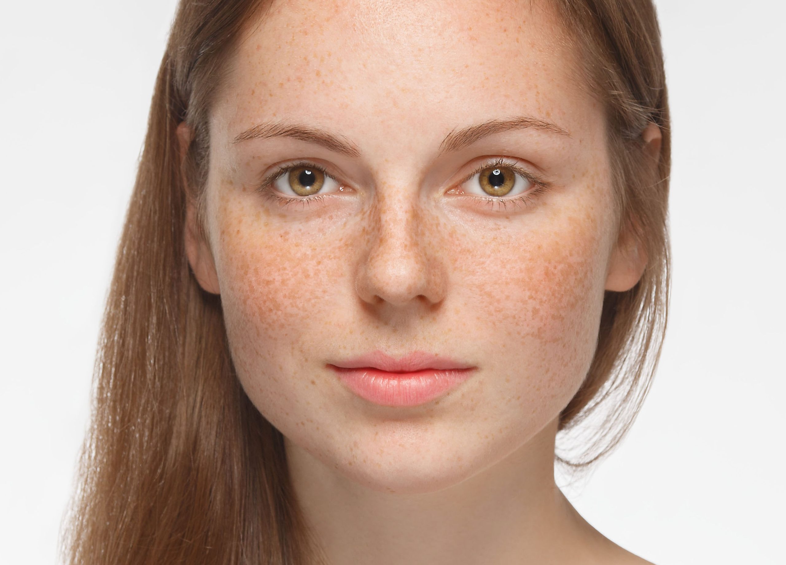 Пигментация