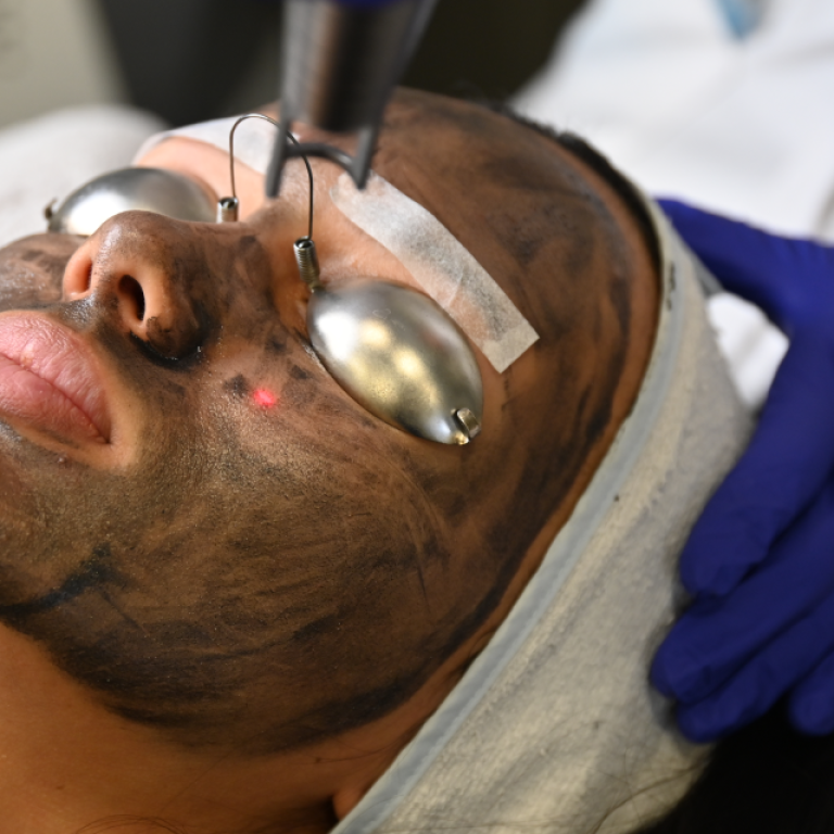 Карбоновый пиллинг (Spectra)​