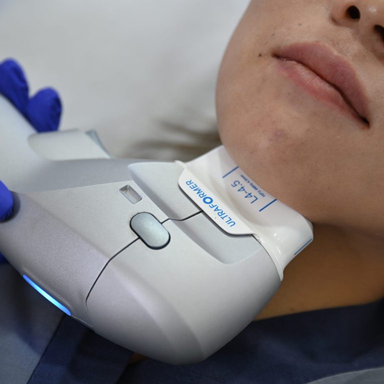 SMAS-лифтинг — безоперационная подтяжка лица с использованием ультразвука